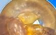 Ovuli di cocaina bloccati nell'intestino, colombiano operato nella notte in stato di arresto