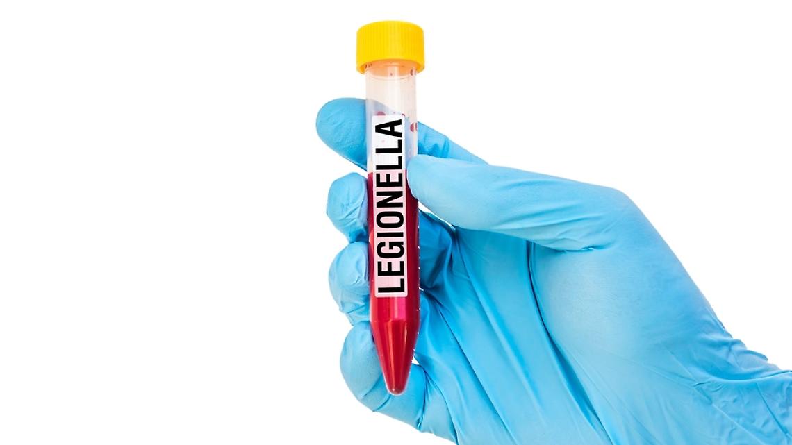Altro caso di legionella: il Comune sospende l'attività di un hotel
