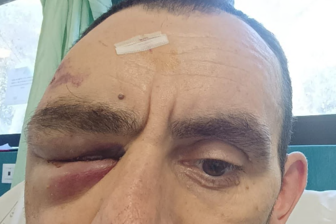 Aggredito mentre torna dal lavoro in bicicletta