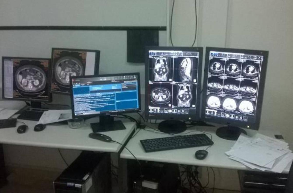 Radiologia chiusa nove giorni, è polemica