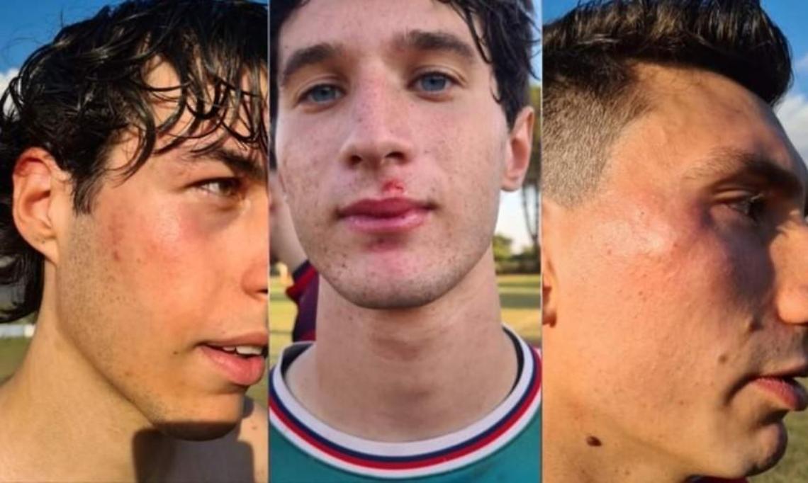 Pugno duro del giudice sportivo per le botte in campo a Doganella: squalificati