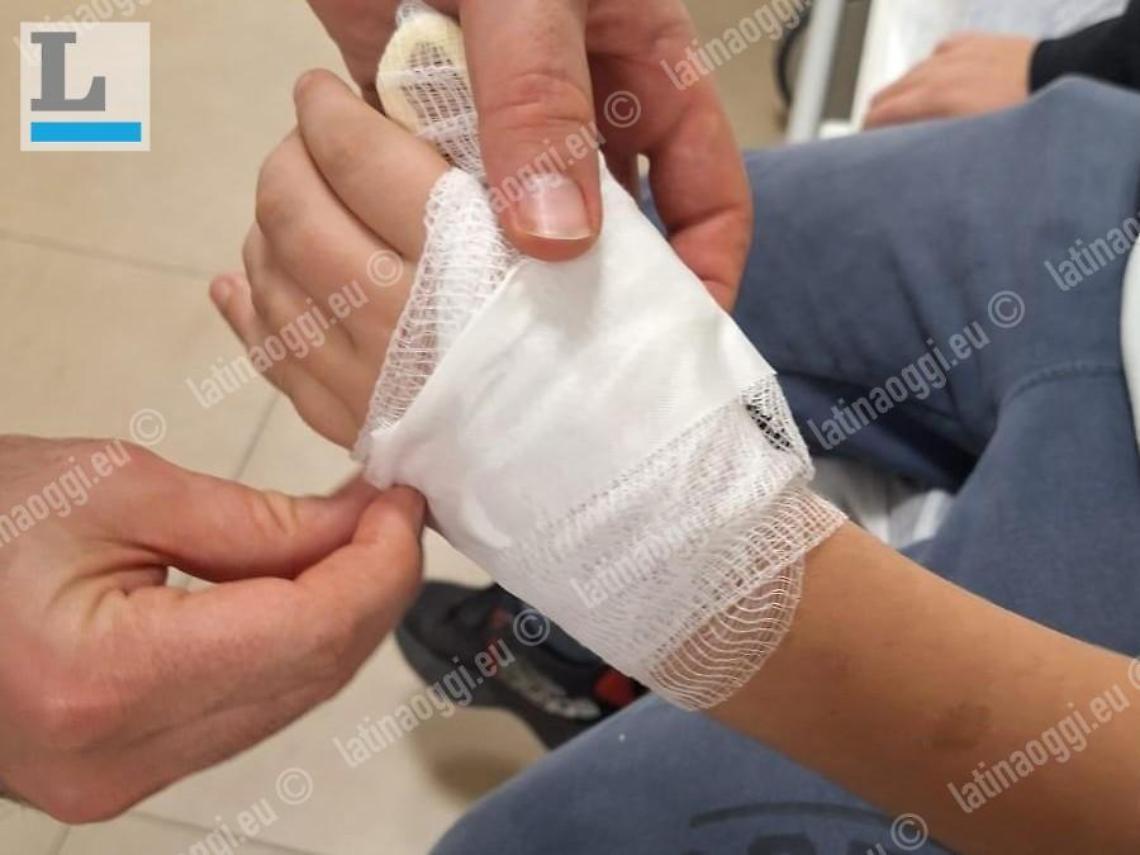 Picchiato in strada dalla baby gang, dodicenne preso di mira e aggredito