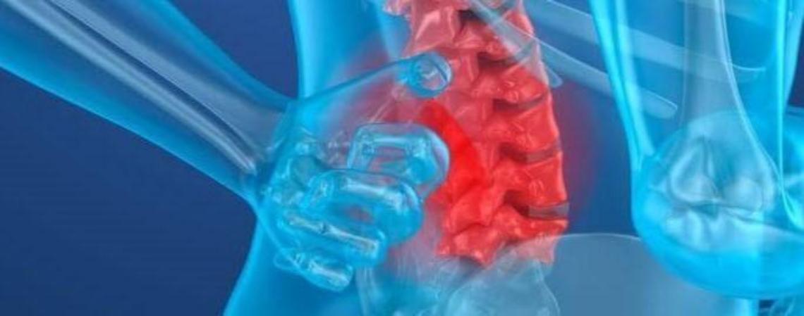 Tumori spinali, come riconoscerli