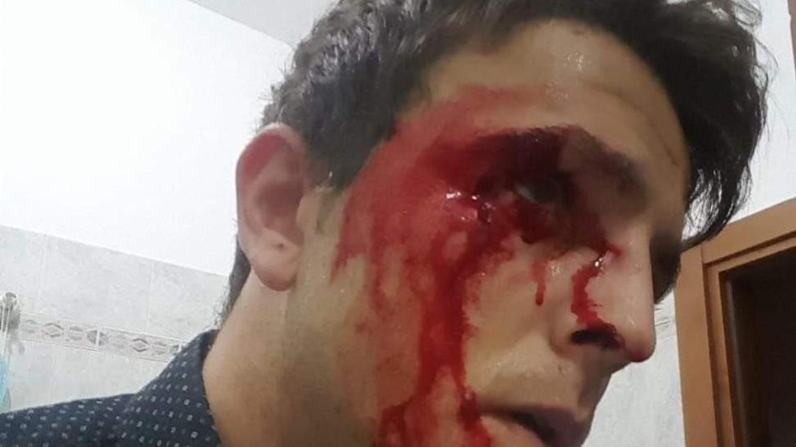 Il consigliere D'Amico ancora aggredito e pestato sotto casa