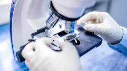 Coronavirus, cinque casi legati alla rsa