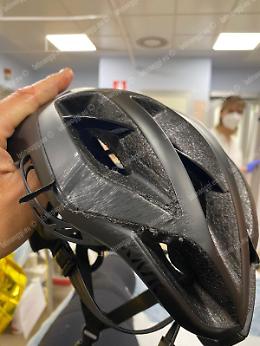 La strada è dissestata, ciclista cade e si ferisce