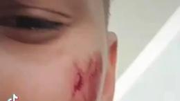 Preso a sassate perché transgender: aggressione in pieno centro