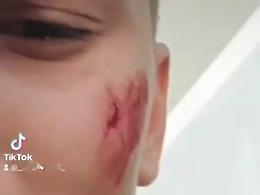 Aggressione omofoba, il Comune si costituirà parte civile