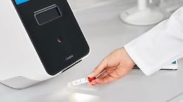 Coronavirus, primi 300mila test sierologici. Simeone: "Meglio tardi che mai"