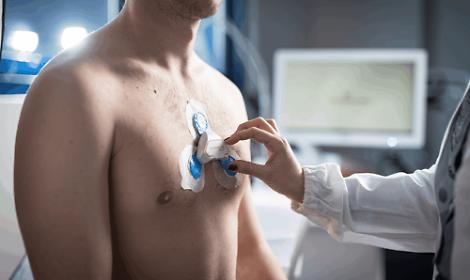 Monitoraggio cardiaco, duemila esami in farmacia