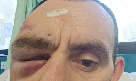 Aggredito mentre torna dal lavoro in bicicletta